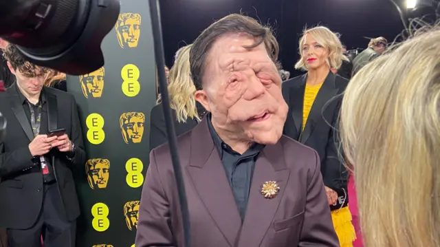 Adam Pearson wears a purple blazer and black shirt and stands in front of a Baftas black backdrop.