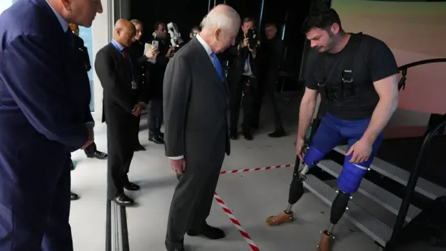 Amputee shows King Charles his prosthetic legs