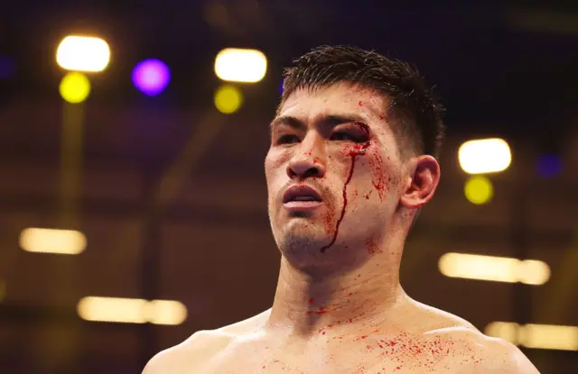 Blood comes down from Dmitry Bivol's face