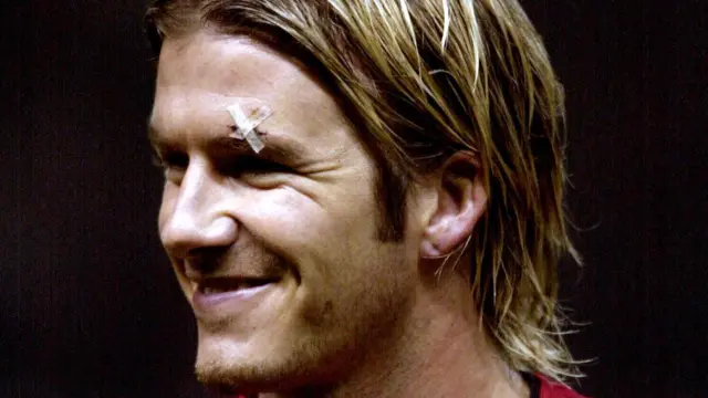 Beckham with cut above eye