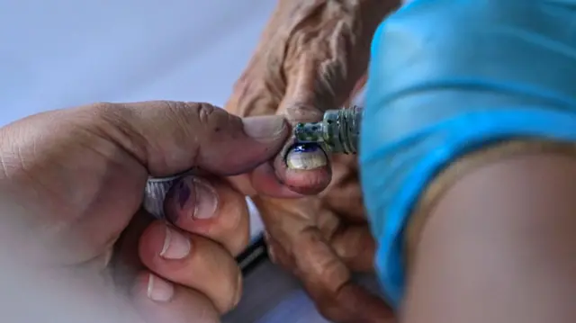 A close-up shot of a pair of hands, with one in a blue glove, dripping ink onto the thumb nail of a wrinkled hand