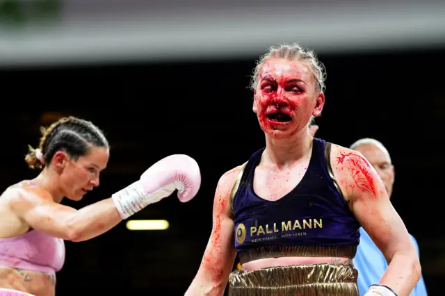 Natalie Zimmerman is covered in blood on her face