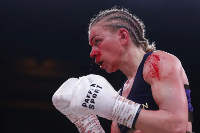 Blood pours from Natalie Zimmerman's face