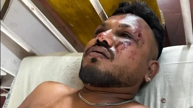 Vishwash Kumar Ramesh in hospital bed.