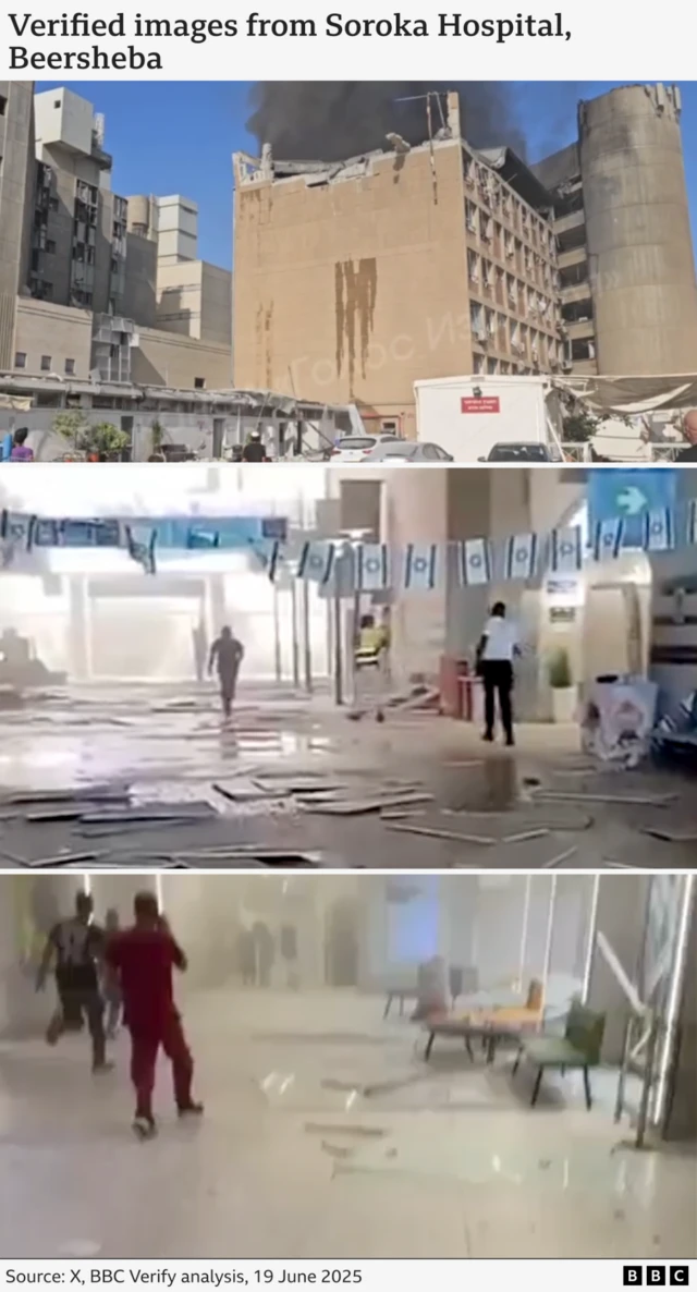 Three images from X showing damage to the hospital in Beersheba damaged by an Iranian missile