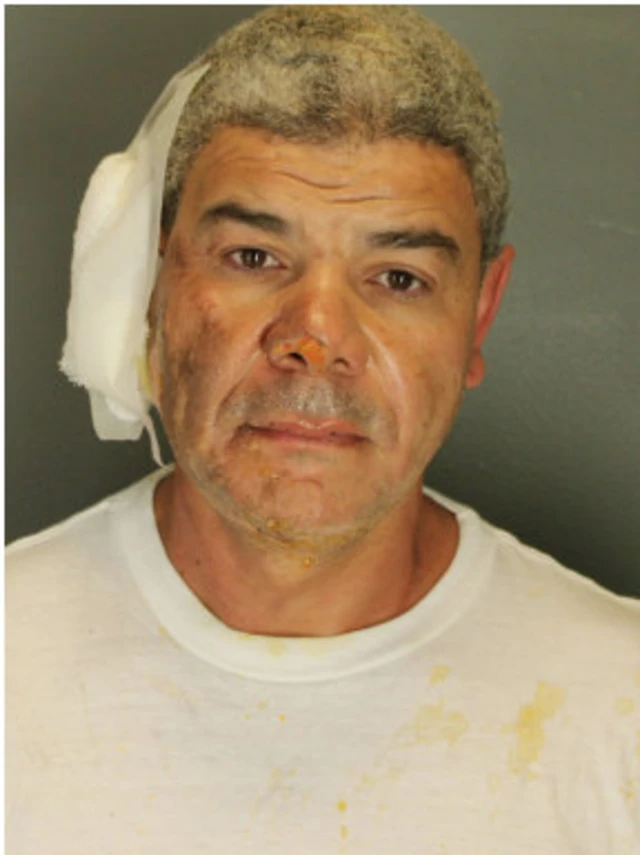 A mugshot of the suspect, who bears a bandage on his right ear, and wears a white t-shirt with yellow stains