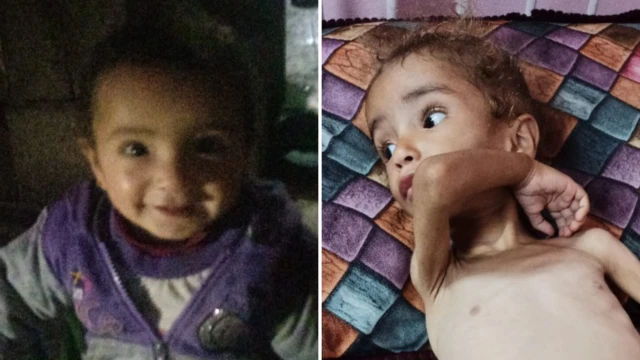 A composite image showing a healthy-looking baby on the left, and a starving baby on the right.