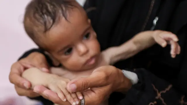 A baby in Gaza held by mother