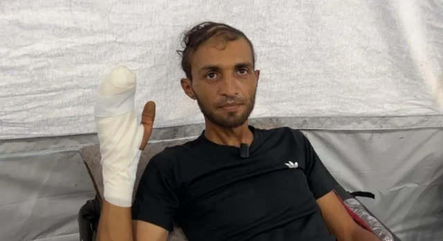 A man in a black Adidas T-shirt holds up his heavily bandaged hand to the camera.
