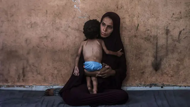 The boy is held by his mother. His bones can be seen through his skin