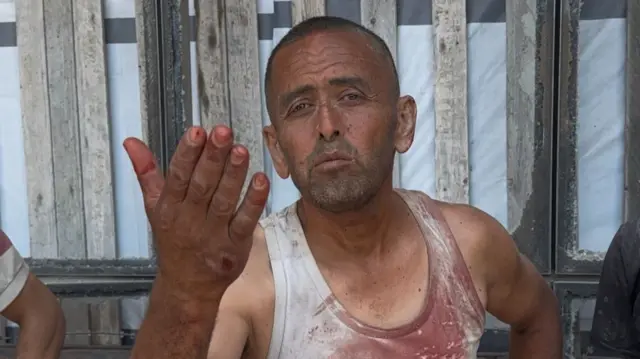 A man holding up one hand and wearing a vest covered in blood.