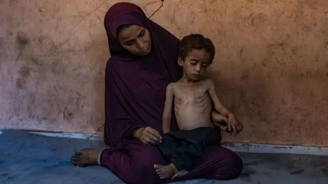 A woman in purple holds her small son, whose ribs show