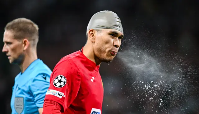 Kairat sub keeper Anarbekov appears to be wearing some kind of shower cap now.