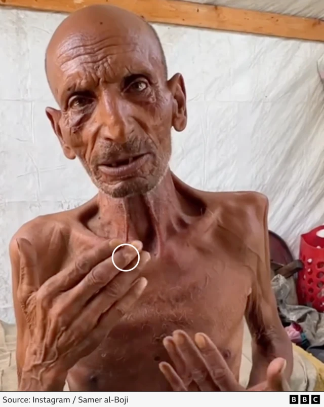 Screengrab from a social media video by Samer al-Boji, showing a close up of an emaciated man, Salim Asfour. The top knuckle on the middle finger of his right hand has been highlighted with a circle.