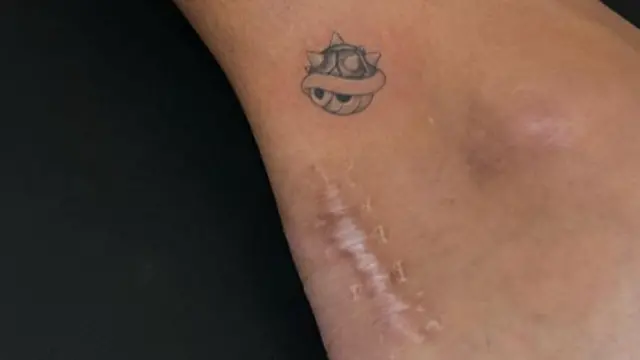 A scar on the Achilles of Katarina Johnson-Thompson with a small tattoo of a blue shell from Mario Kart above it