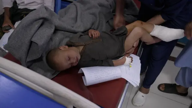 A child sleeping on a bed with his left food in a cast