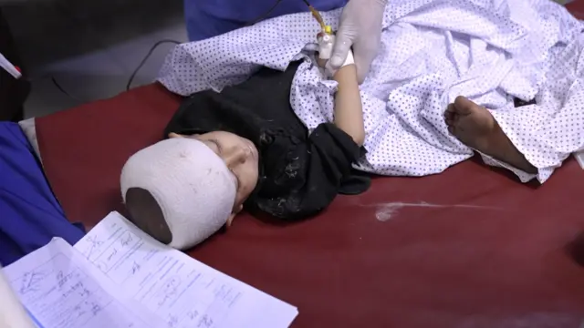 A child with his head in a bandage sleeping on a red bed. His lower body is covered with white polka-dotted fabric