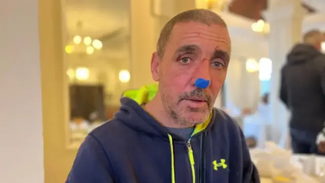 Man with blue plaster on his nose, with scratch injuries on nose and eyebrow