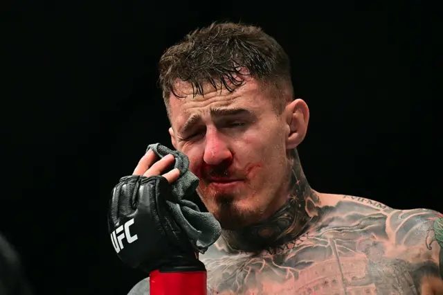 Tom Aspinall holds a cloth to his eye