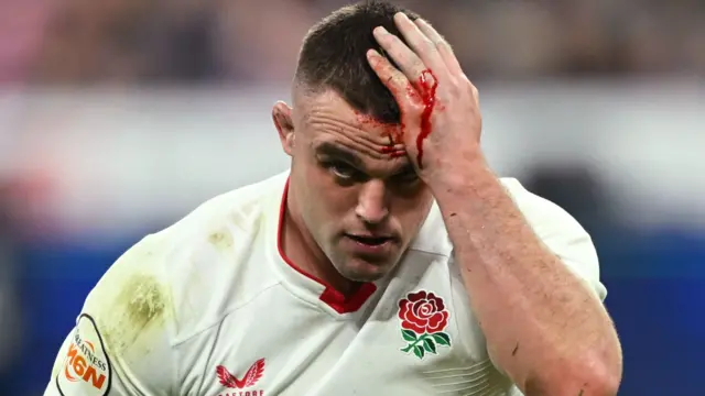 Ben Earl holds his bleeding head after a cut