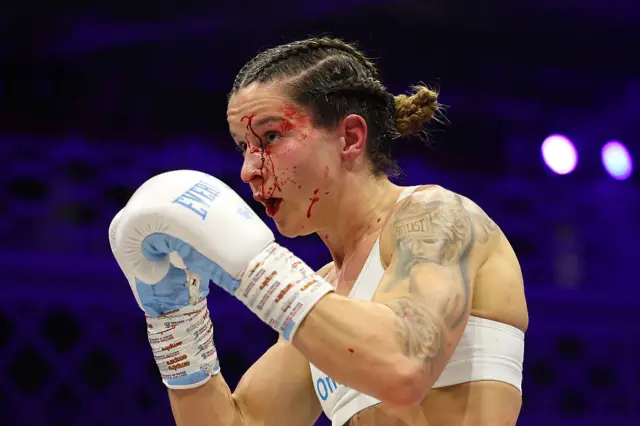 Terri Harper looks on with blood on their face