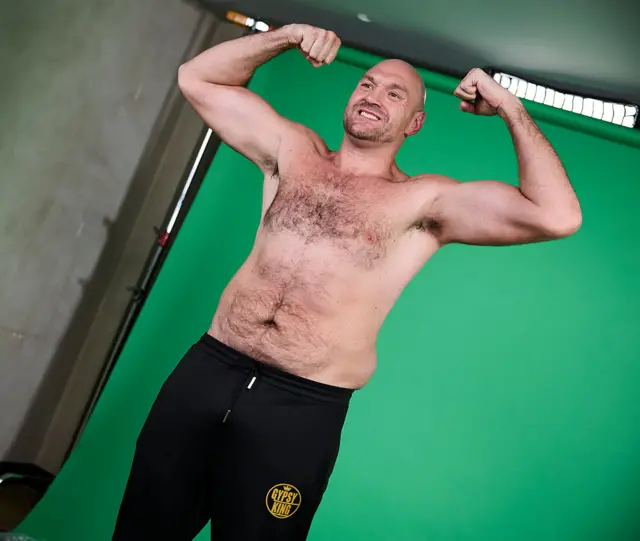 Tyson Fury poses with his top off