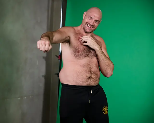 Tyson Fury poses with his top off
