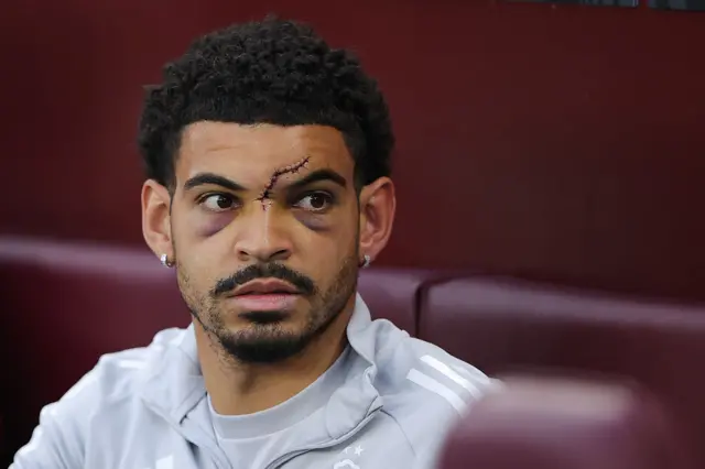 Morgan Gibbs-White has a scar on his forehead