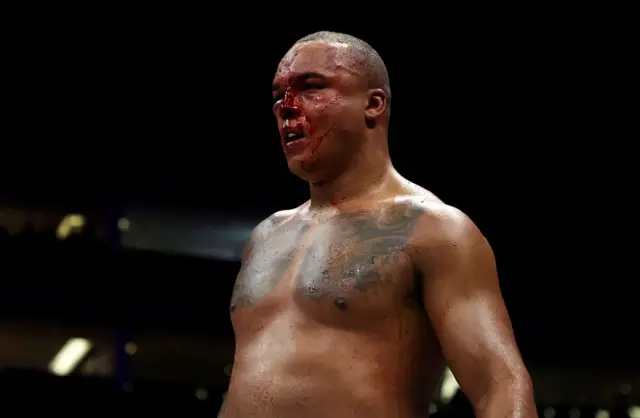 Fabio Wardley's nose is bloodied and broken