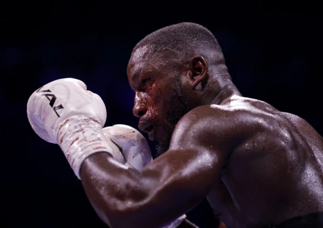 Blood comes out of a cut under Ekow Essuman's eye