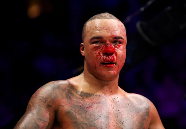 Fabio Wardley with a cut nose