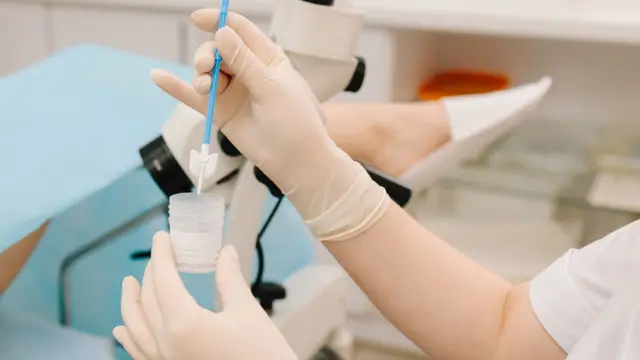 Gynecologist collects a Pap smear sample for cervical screening.