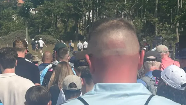 Spectator's sun burn