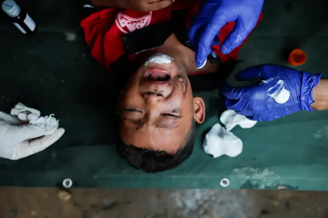 A child screams in pain as he receives treatment for injuries following flash floods and mudslides in Nepal.