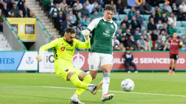 Hibs v Shkendija