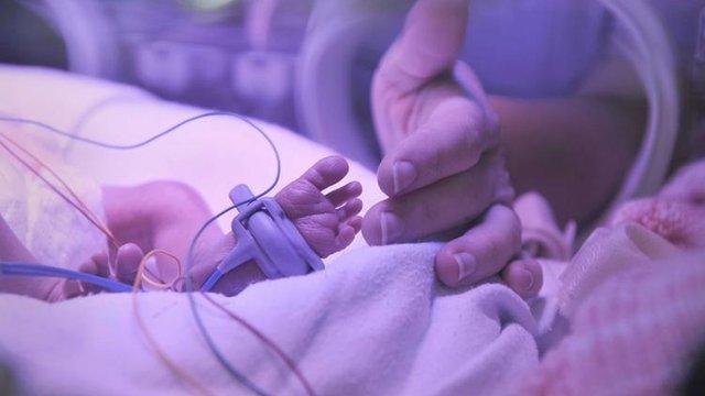 Baby in incubator