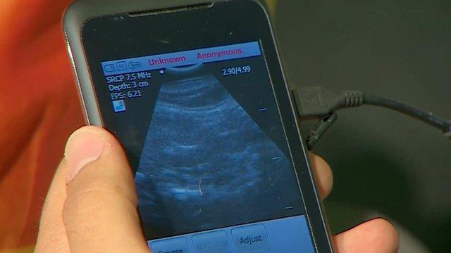 Ultrasound on smartphone