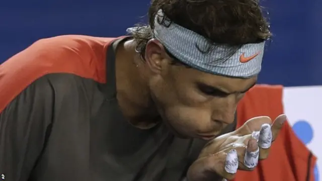 Rafael Nadal attends to his blistered hand