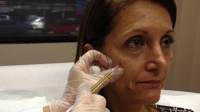 A woman being injected with her own blood enriched with platelets.