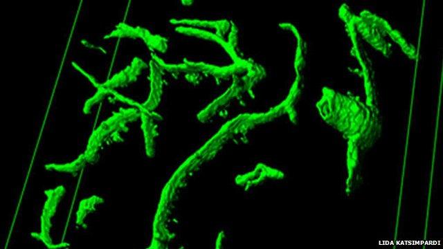 The blood vessels of old mice were rejuvenated (Image: Lida Katsimpardi)