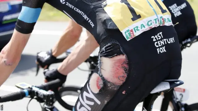 Chris Froome after his injury on stage four