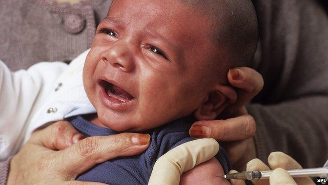 Childhood TB can be harder to detect than the adult form of the disease