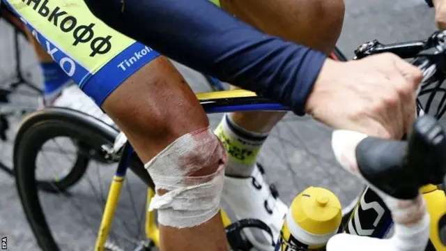 Alberto Contador's injured knee