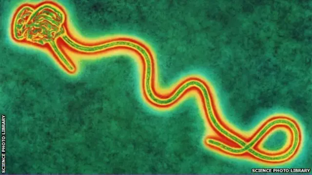 Coloured transmission electron micro graph of a single Ebola virus, the cause of Ebola fever