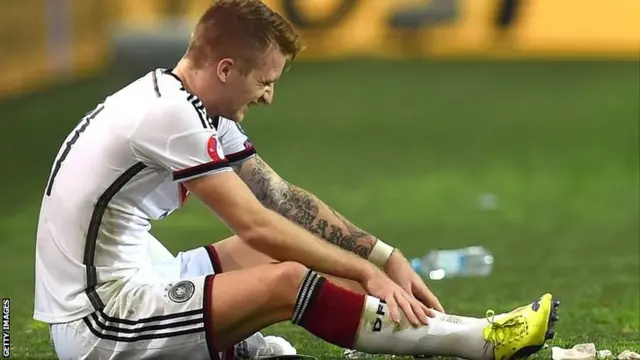 Marco Reus is injured against Scotland