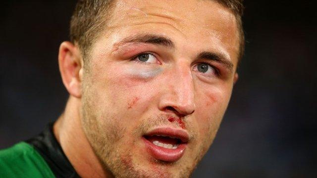 Sam Burgess