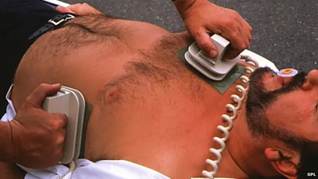 Defibrillator being used