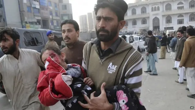 A Pakistani girl, who was injured in a Taliban attack in a school, is rushed to a hospital in Peshawar, Pakistan, 16 December 2014