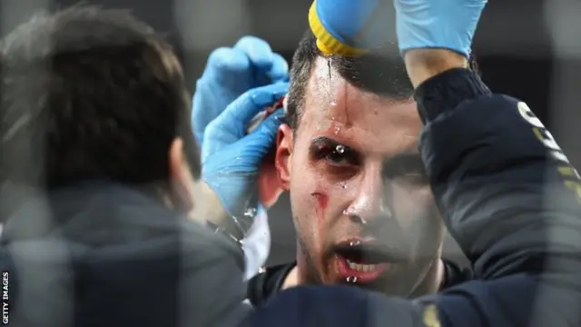 Steven Taylor has treatment on a cut