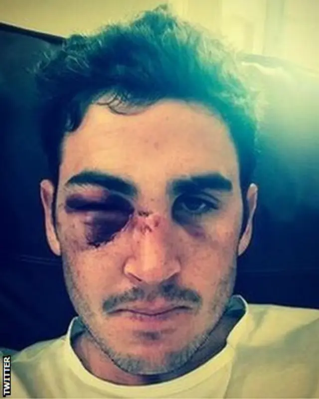 Craig Kieswetter